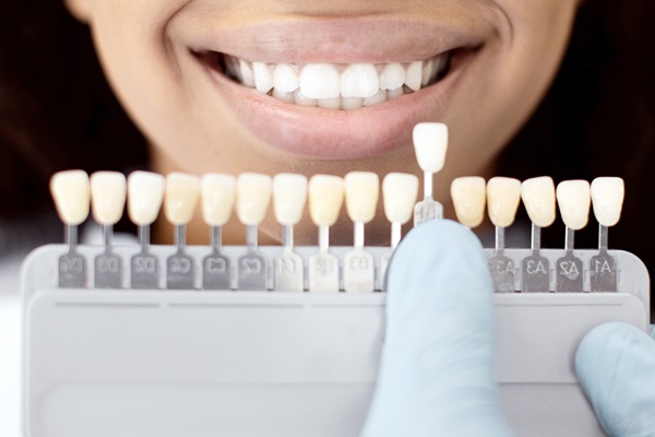 Ways Dental Bonding Can Improve Your Smile