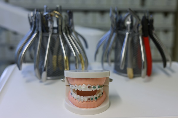 Dental Teeth Straightening Can Help To Prevent Plaque Build Up